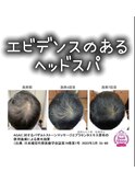 エビデンスのあるヘッドスパ