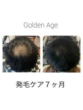 ゴールデンエイジ(Golden Age) 【発 毛 ケ ア 7ヶ月】