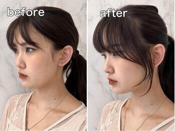 ウィル 江坂店(WiLL)の写真/TOPスタイリストが<デザイン><再現性><モチ>を実現！あなた史上最大の可愛いを手に入れて…