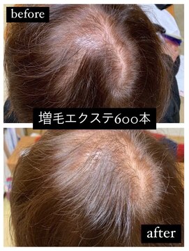 インクリース(increase) 増毛エクステ