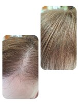 ユーフォルムギンザ(y-Forme Ginza)&nbsp;話題のトキカタ♪前髪編