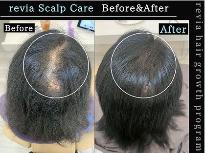 レヴィア(revia)の写真