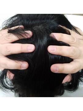 ルーミールーム(RoomieRoom) 頭皮改善ビーフォーアフターで小顔に。