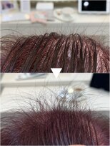 レヴィア(revia)&nbsp;プレミアム育毛促進美髪コース10ヶ月後の効果［水戸／髪質改善］