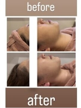 サロンデベレーザ(salon de belleza) ララピール