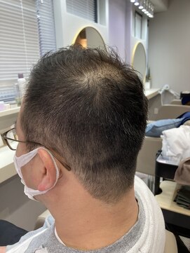 アオ 花咲町(a-o) スッキリソフモヒスタイル!