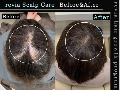 レヴィア(revia)の写真