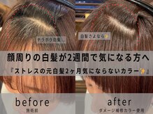 ルクス(Lux)の雰囲気(《顔周りの白髪が2週間で気になる》ならオススメな施術◎)