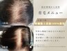 【人気No.3】京都唯一の幹細胞上清液100%使用の髪の育毛促進TR(細毛改善)