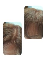 ユーフォルムギンザ(y-Forme Ginza) 話題のトキカタ♪前髪編