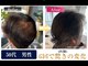 ドクターヘアー(Dr.hair)の写真