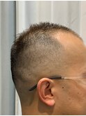 ボウズ風０mmフェード