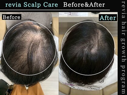 レヴィア(revia)の写真