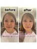 【小磯限定クーポン】脱疲れ顔が叶う！ハツラツ小顔spa30分+TR