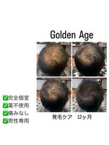 ゴールデンエイジ(Golden Age)&nbsp;【　発　毛　ケ　ア　１２ヶ月】Before＆Afte