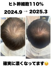 モエちょき ヒト幹細胞110%エアバリ