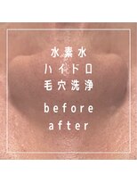 ルポ(repos) 水素水ハイドロ毛穴洗浄