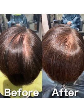 ツムグ 代官山 中目黒(TUMUGU) 地肌見え・つむじ割れ解消/ボリュームアップエクステ