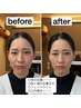 【チケット】骨格補正スパ(回数券)＋カット　　￥5500