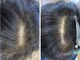 ヘアサロン エイムモード(hair salon aim mode)の写真/頭皮、毛の細さが気になる方におすすめ◎ターンオーバーに着目した#強髪トリートメント#電気バリブラシ使用