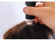【マイクロスコープ診断】最新のテクノロジーを備えた独自の診断システムも導入