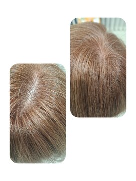 話題のトキカタ♪頭頂部編