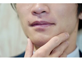マスタッシュ(MUSTACHE)の写真/清潔感UP！シェービング・眉毛カットで好印象に◎ヒゲ光ケアでスマートな毎日を♪