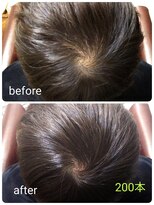 グリーン(green) つむじカバーボリュームアップエクステ200本☆