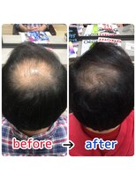 ルーミールーム(RoomieRoom)&nbsp;あの時の髪を取り戻す名古屋ふさふさプロジェクト30代40代50代