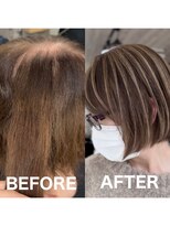 レディアル 大宮(REDEAL ope.) 【白髪手術】 ベージュ白髪手術/白髪ぼかし/ハイライト