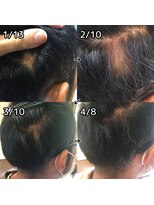 ルーミールーム(RoomieRoom)&nbsp;頭皮改善！育毛促進ケア！