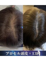 サロン モーリー(salon morley) プロセラセラピーズ
