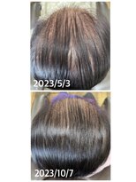 エミ(EMI)&nbsp;育毛促進