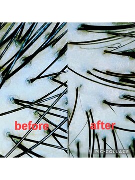 アナザードア(another door) ヘッドスパ【頭皮環境の違い】