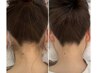 ☆【襟足のムダ毛悩み】うなじ美肌ケア相談＆カウンセリング（要問い合わせ）