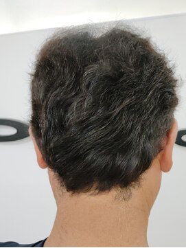 ぶろんそん 白髪染め