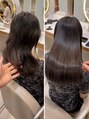 エレン(E L E N) リアルなお客様の症例です。