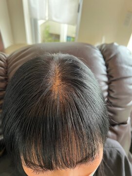 アローズ(arose) 3D増毛