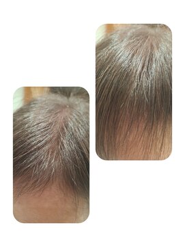 ユーフォルムギンザ(y-Forme Ginza) 話題のトキカタ♪前髪編