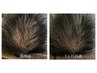 初回 ロミキュア 再生因子ケア、エクソソーム、幹細胞、プラセンタ、LED照射