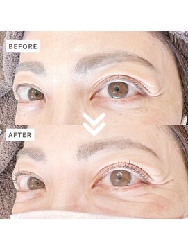 ディーディーフォルム(DD form) オトナ女子のためのパリジェンヌ