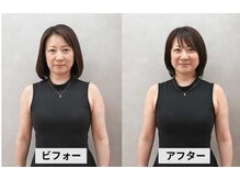 ビフォーアフター　正面