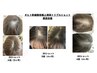 【最新・再生美容】白髪・ボリューム・育毛促進お悩み無料カウンセリング