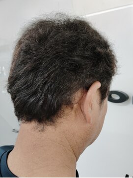 ぶろんそん 白髪染め