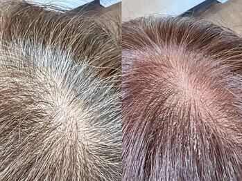 アニマ(ANIMA)の写真/ANIMAの≪高濃度水素トリートメント×白髪染め≫で白髪ケアしながらついつい触りたくなる柔らか髪に♪