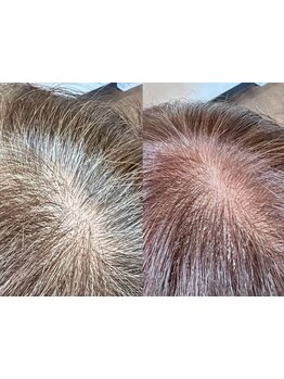 ANIMAの≪高濃度水素トリートメント×白髪染め≫で白髪ケアしながらついつい触りたくなる柔らか髪に♪