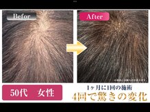 ドクターヘアー(Dr.hair)