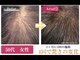 ドクターヘアー(Dr.hair)の写真