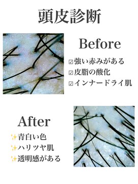 アフロート ルヴア(AFLOAT RUVUA) 【ヘッドスパ】頭皮ケア 頭皮診断 髪質改善 30代40代50代 新宿