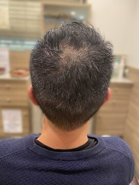 銀座マツナガ 神田店 似合わせカットビジネスショート刈り上げハチ張り改善◎